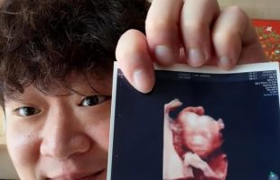 ����̹���